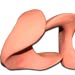 Ortoplasti